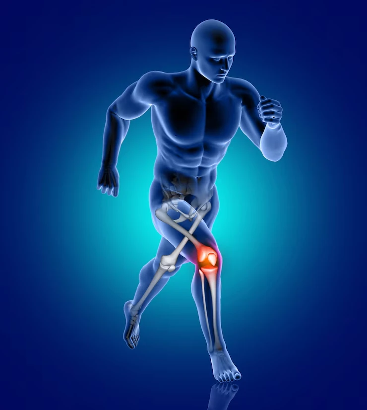 Types of Knee Replacement Surgery