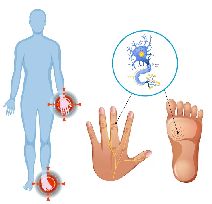 How Do We Diagnose Neuropathic Pain?