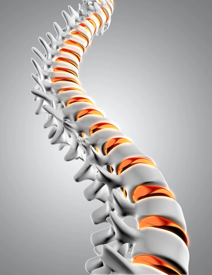 Prolapsed Intervertebral Disc | From Symptoms to Effective Treatment