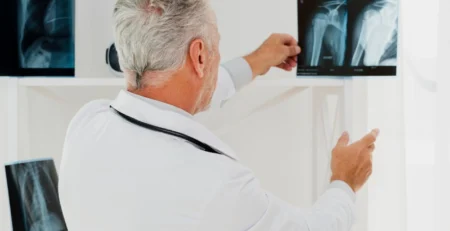 What is Osteoporosis? Learn How to Manage, Prevent, Be Healthy & More