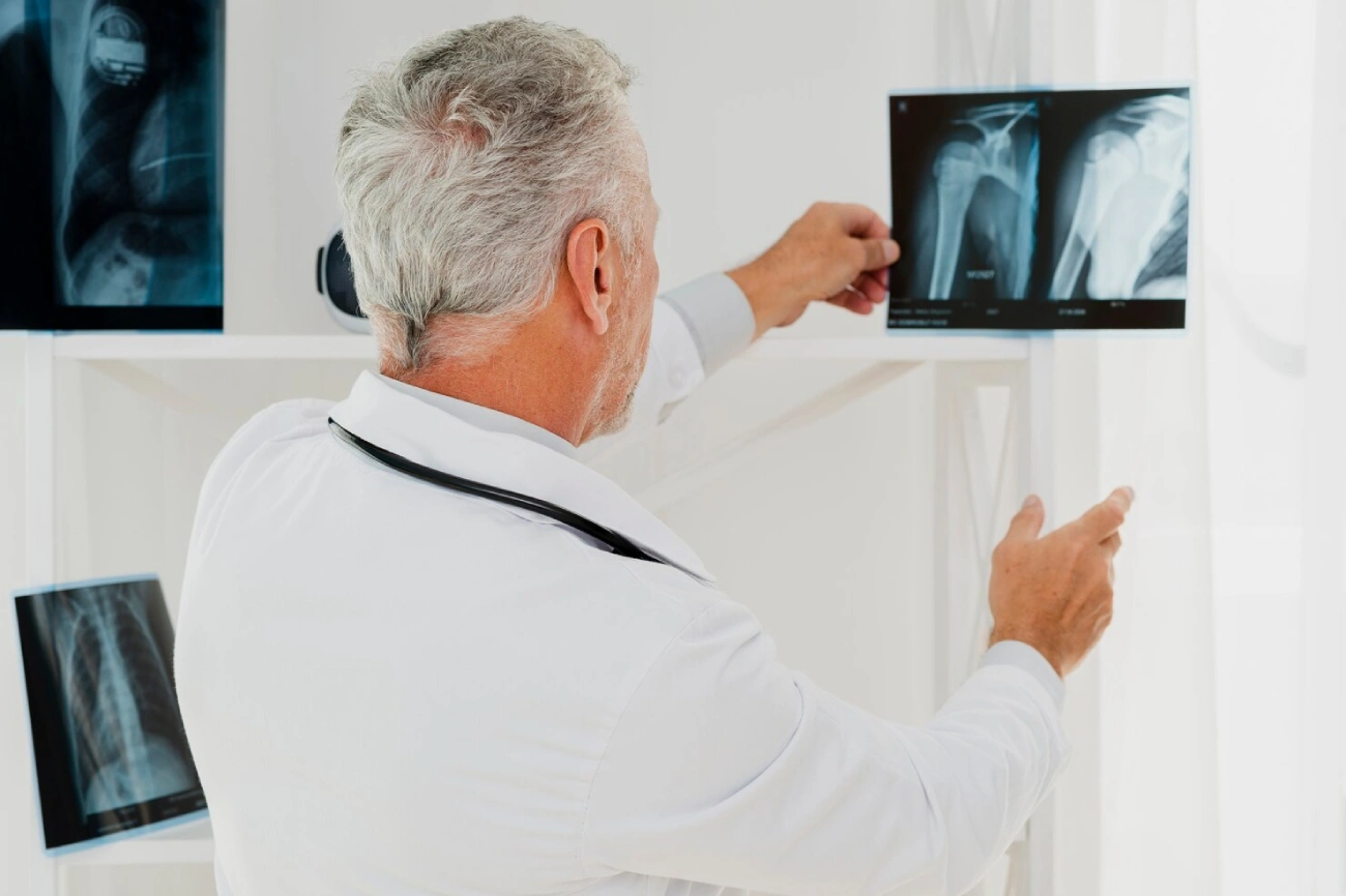 What is Osteoporosis? Learn How to Manage, Prevent, Be Healthy & More